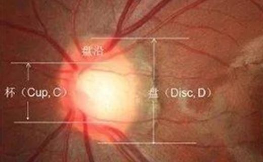 一文读懂体检报告中的眼底“密码”（上）