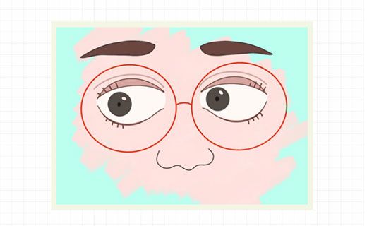 朱梦钧：OK镜怎么配戴才安全有效？