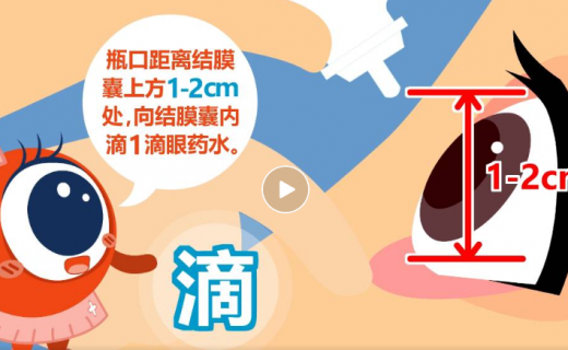 孩子得了过敏性结膜炎，如何合理用药？