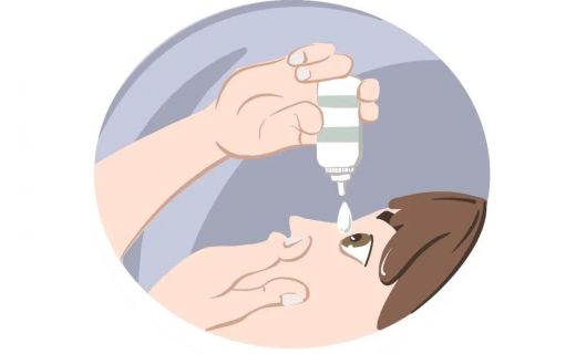 青光眼患者每天什么时候点眼药水？