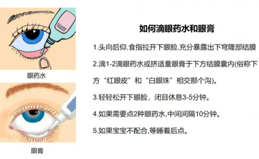 儿童可否用“沙星”类眼用制剂？