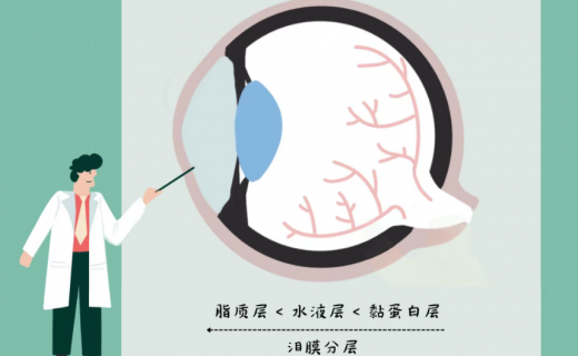 眼睛干巴巴？ 教你挑对“人工泪液”