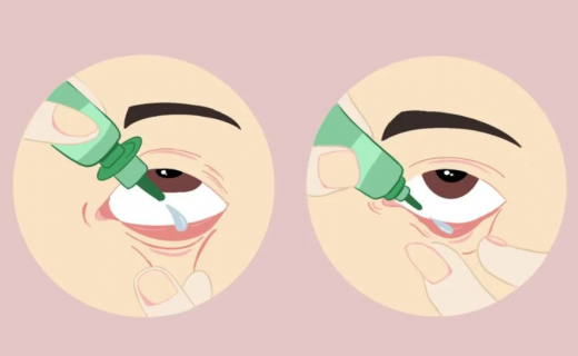 七夕赴浪漫之约，先护好眼压！