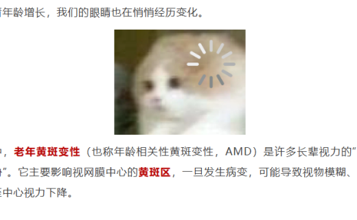 50岁后，这6件事对眼睛至关重要